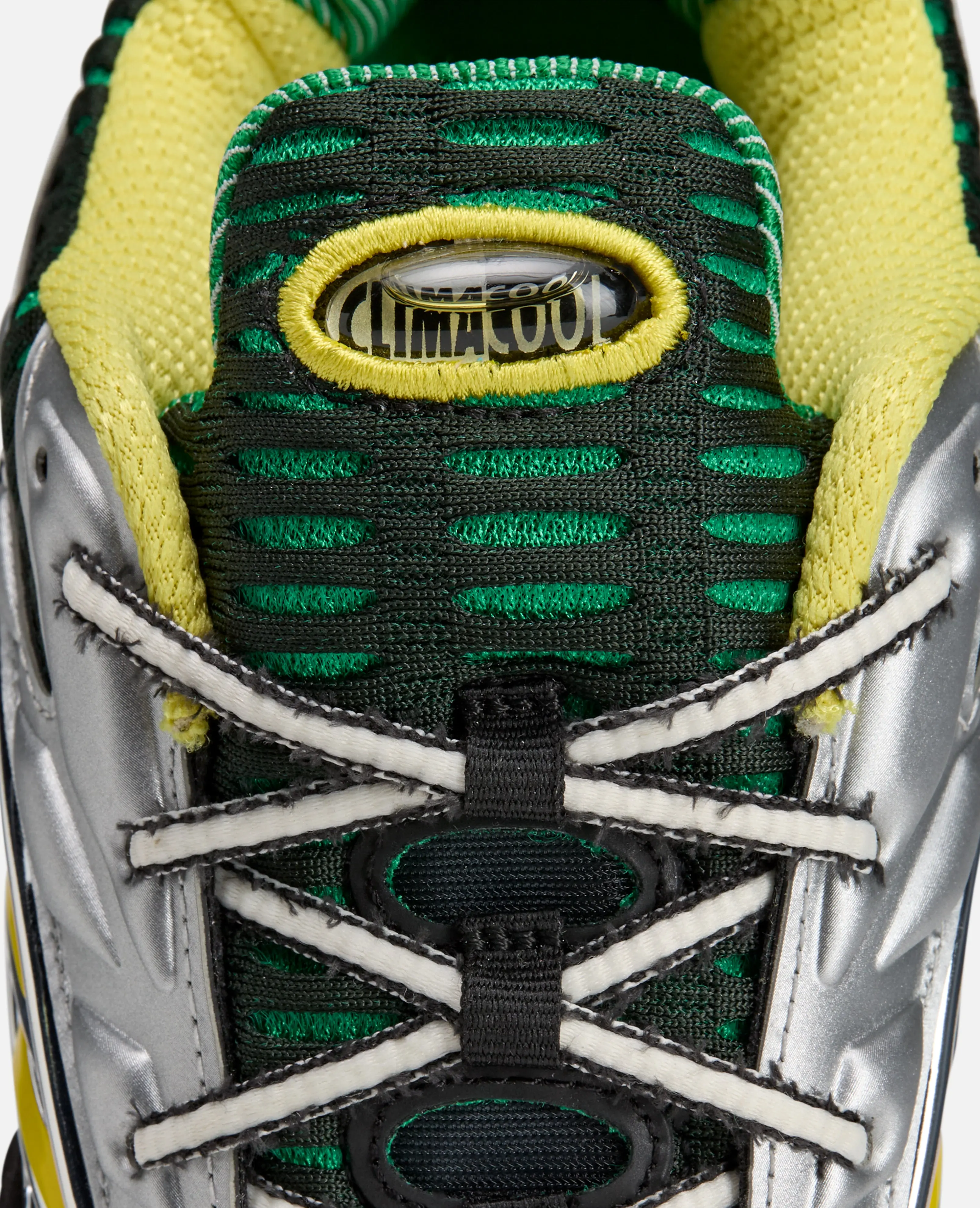 adidas X Brain Dead (Core Black/Impact Yellow/Silver Metal) - Image 7